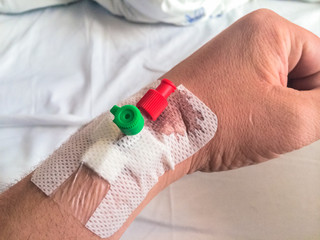 Intravenous cannula, Venflon