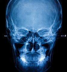 Photo X-Ray scan human