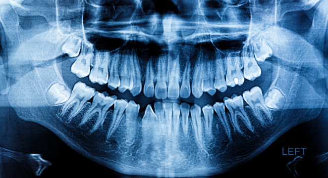 Photo X-Ray scan human