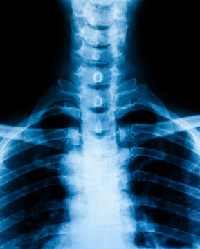 Photo X-Ray scan human