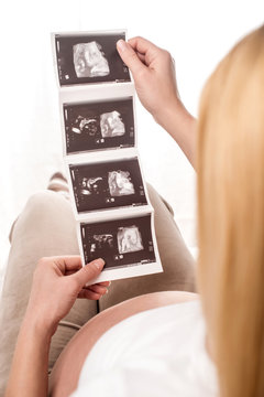 Pregnant woman holding ultrasound baby scan
