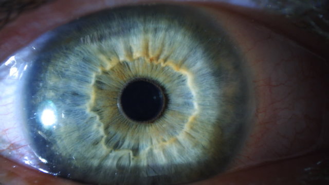Extreme Eye