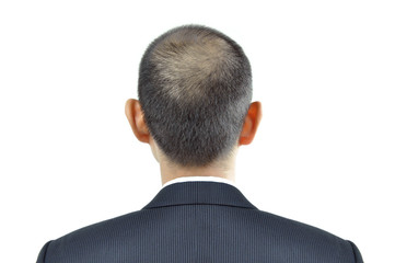 Hair thinning symptom on a man head