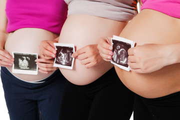 Close up of three pregnant women holding ultrasound scan on her
