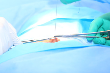 Doctor suturing open wound
