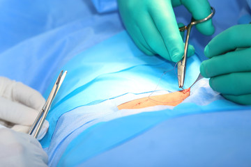 Macro shot of doctors making a suture in operation room.  Focus