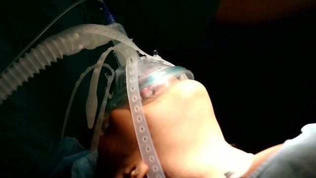 Unidentified girl breathing in the oxygen mask in operation room