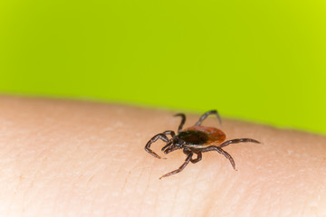 Castor bean tick, Ixodes ricinus crawling on human skin