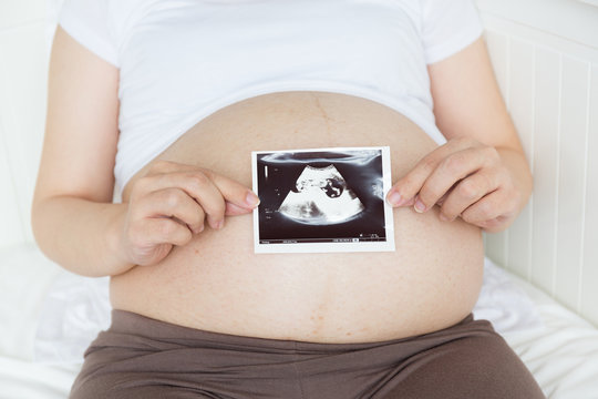 Pregnant belly with ultrasound photo
