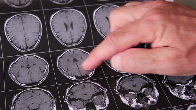 Arzt &uuml;berpr&uuml;ft MRI Aufnahmen