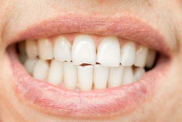 teeth. close-up