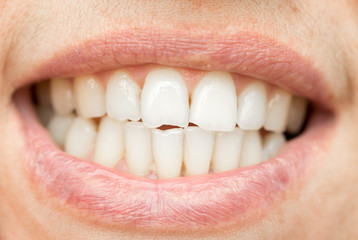 Obraz premium teeth. close-up