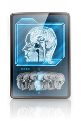 Modern tablet showing MRI images