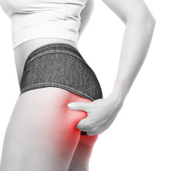 Frau zeigt ihre Cellulite am Oberschenkel