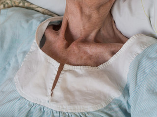 Very skinny old woman lying in a bed - obrazy, fototapety, plakaty