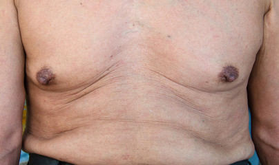 Naklejka premium elderly man with a cellulite on a stomach