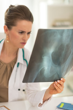 Concerned doctor woman looking on fluorography
