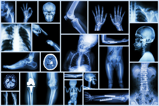 Collection X-ray multiple part of human