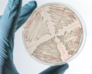 Yeast cells (saccharomyces cerevisiae) streaked on agar plate