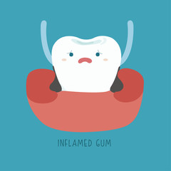 Inflamed gum of dental Illustrator