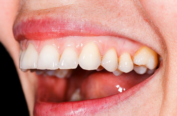 Fototapeta premium Beautiful smile