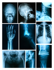 Collage of many X-rays. Very good quality