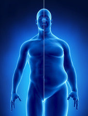 Obesity concept in x-ray
