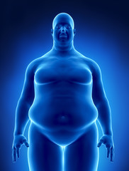 Obesity concept in x-ray