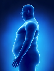 Obesity concept in x-ray left view