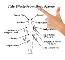 Sife Effects From Sleep Apnea