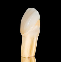Dental ceramic crown