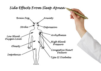 Sife Effects From Sleep Apnea