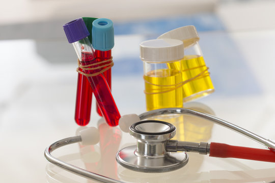analyse de sang et d'urine