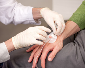 Arzt legt einen Venenkatheter an der Hand