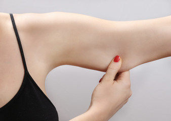 Woman holding a hand with excess fat