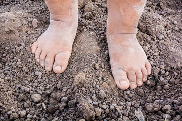 children foot is stained and dirty