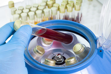 centrifuging blood and biological samples