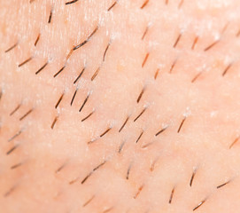 the bristles on the skin. close-up