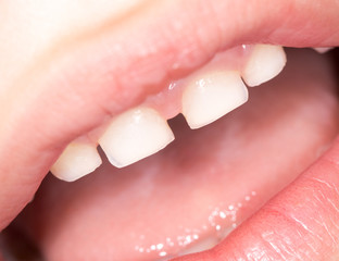 teeth in the mouth. close-up