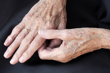 Schmerzende alte Hände