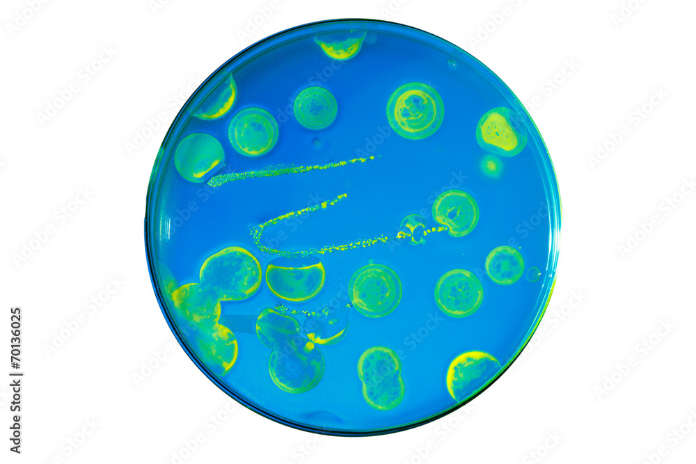 Wall mural Growth of pathogenic bacteria populations populations from comme