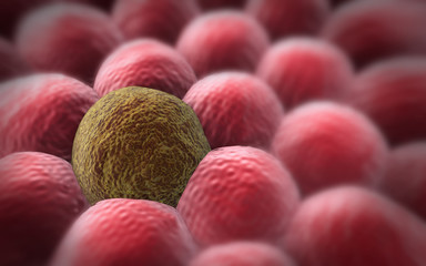 cancer cell