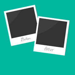Before after instant photo. Flat design