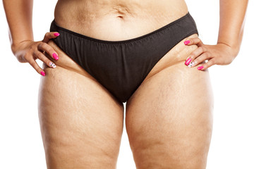 hips of a very thick woman in black panties