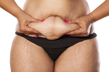 very fat woman pinching her stomach with her ​​fingers