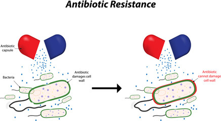Antibiotic Resistance