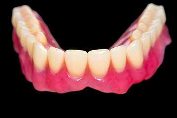 Lower denture