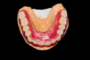 Lower denture