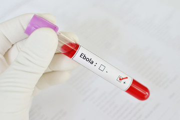 Obraz premium Ebola positive