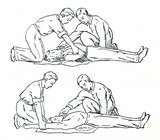 &quot;Artificial respiration (Schaefer's method)&quot; Stock photo and royalty